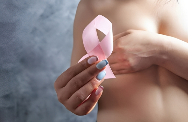 Cáncer en Venezuela: SAV prevé más de 83 mil nuevos casos al año y urge a fortalecer la prevención